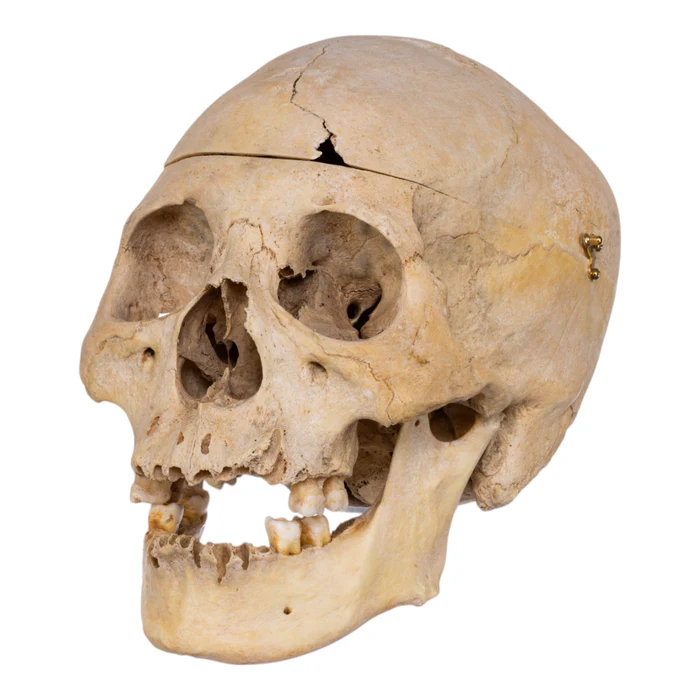 Real human skull specimen with detailed anatomy for research and teaching.