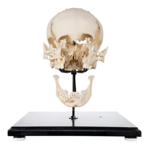 Front view of a real human exploded skull on stand