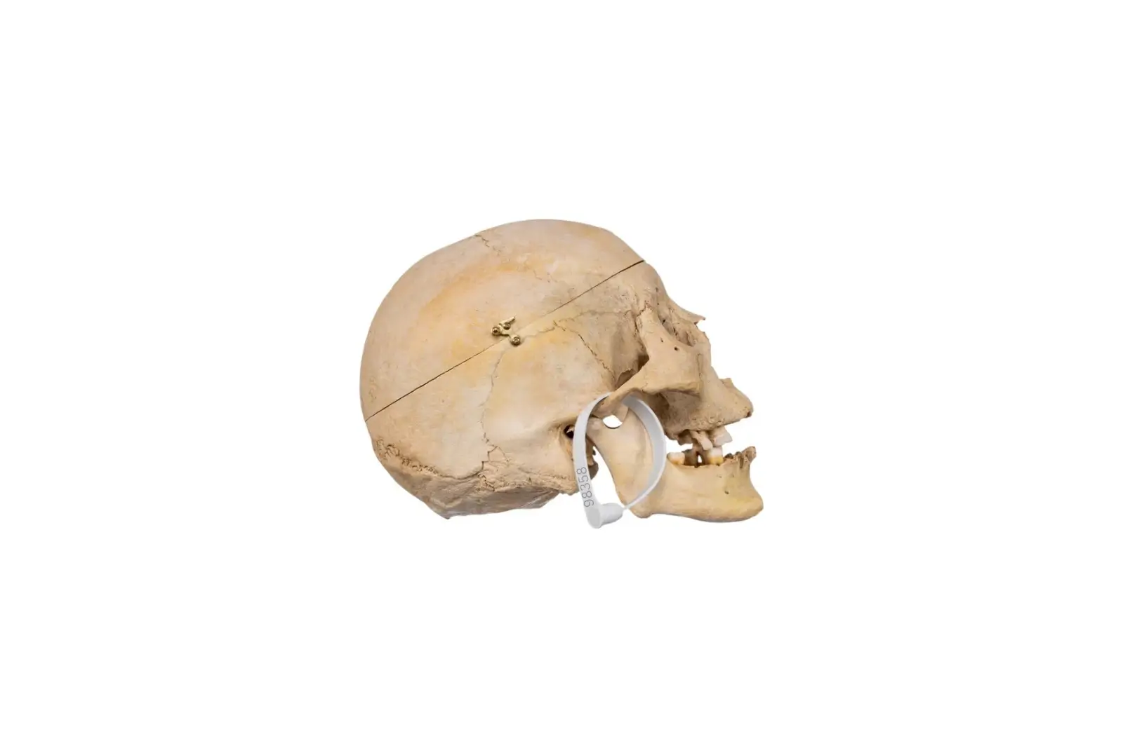 Real human skull specimen with detailed anatomy for research and teaching.