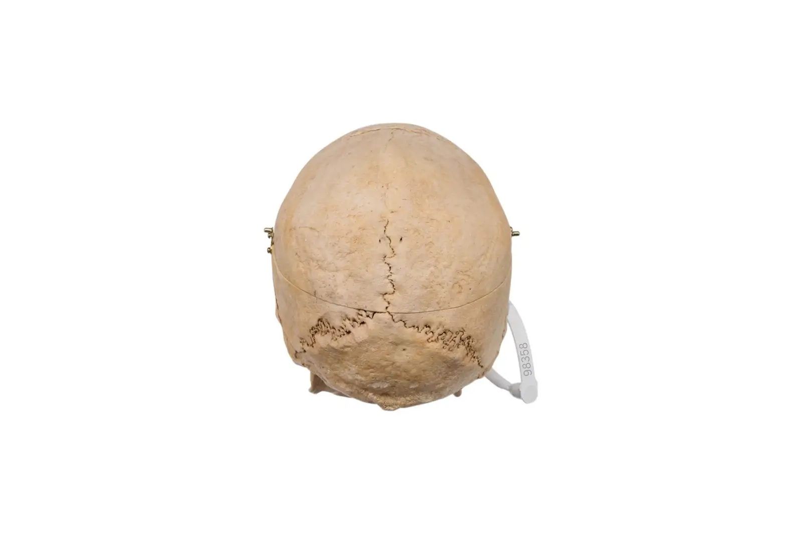 Real human skull specimen with detailed anatomy for research and teaching.