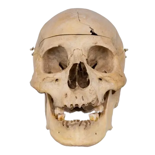 Real human skull specimen with detailed anatomy for research and teaching.