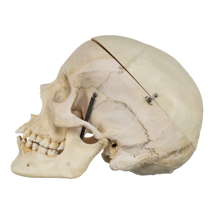 Real Human Skull GHS41414
