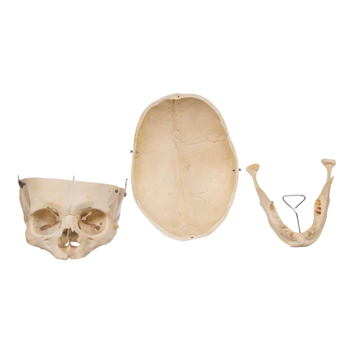Real Human Skull GHS76731