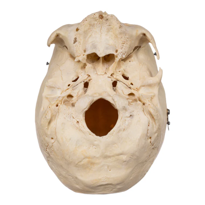 Real Human Skull GHS76731