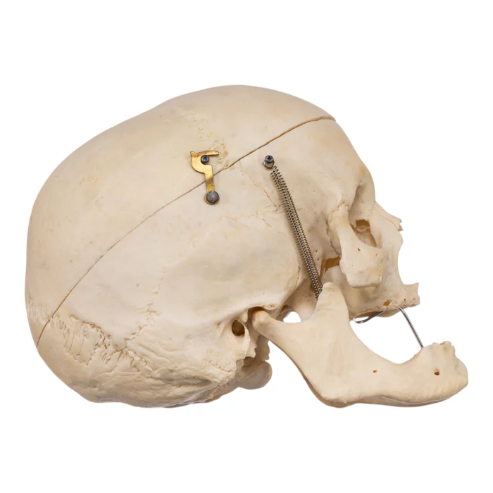 Real Human Skull GHS76731 side view