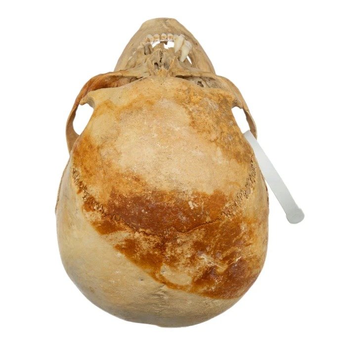 Real Human Skull For Sale