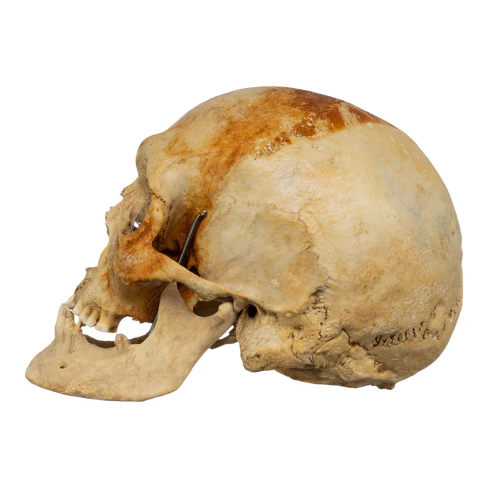 Real Human Skull For Sale GHS79253